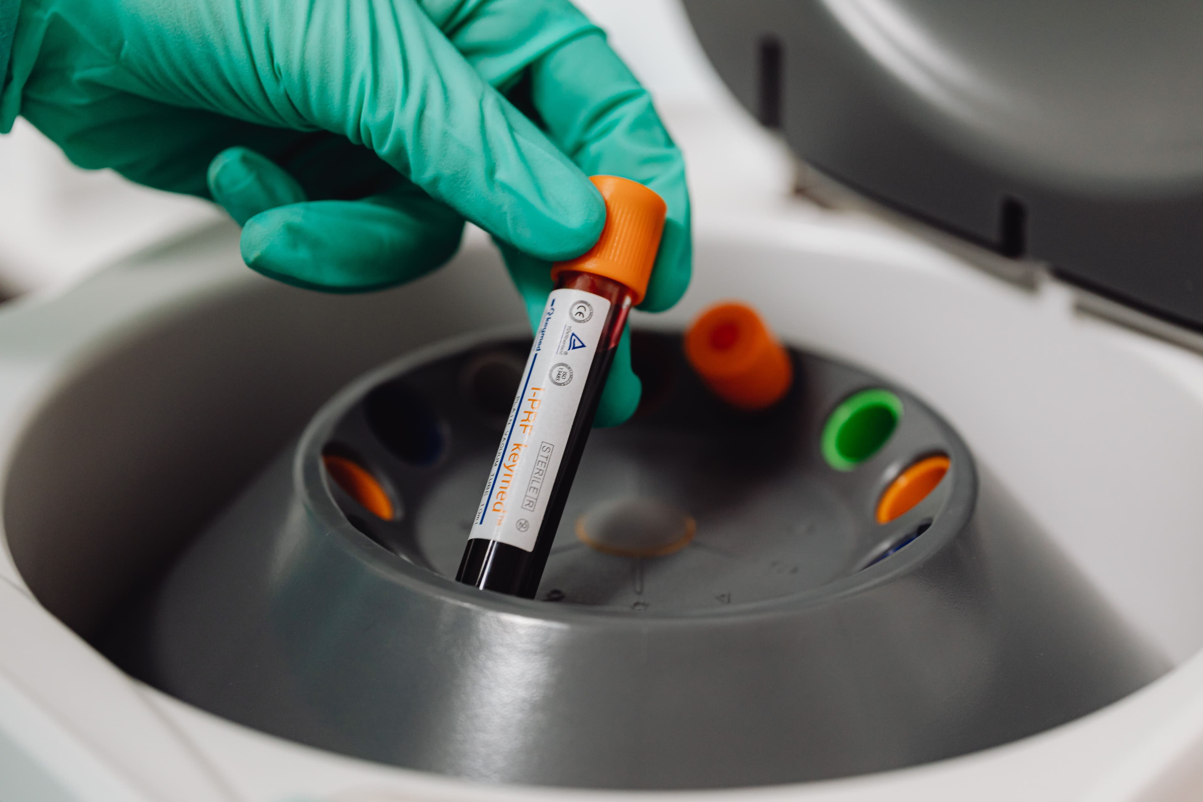 Biological Age Tests: What They Actually Measure