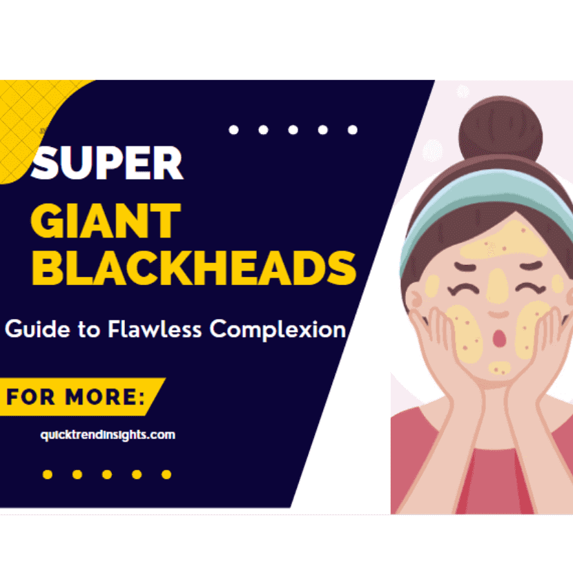 Super Giant Blackheads: Guide to Flawless Complexion